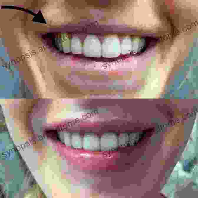 Before And After Smile Transformation By Meredith Schorr As Seen On TV Meredith Schorr