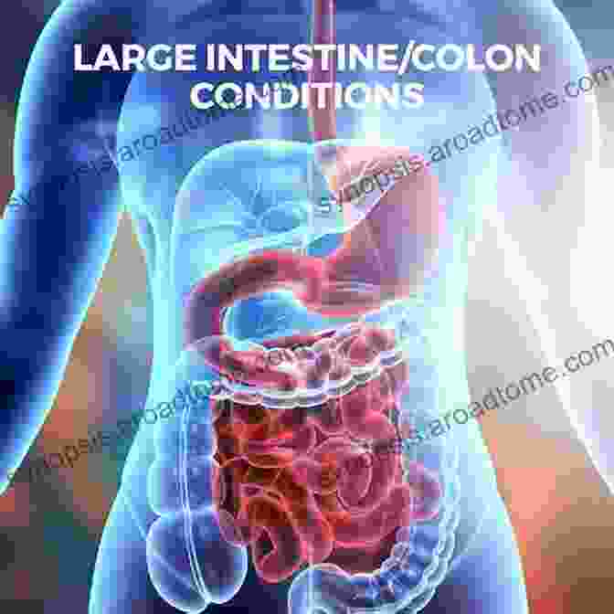 Diverticulitis: A Common Condition That Affects The Large Intestine DIVERTICULITIS SOLUTION: The Ultimate Guide To Diverticulitis Problem Causes Symptoms And Treatment