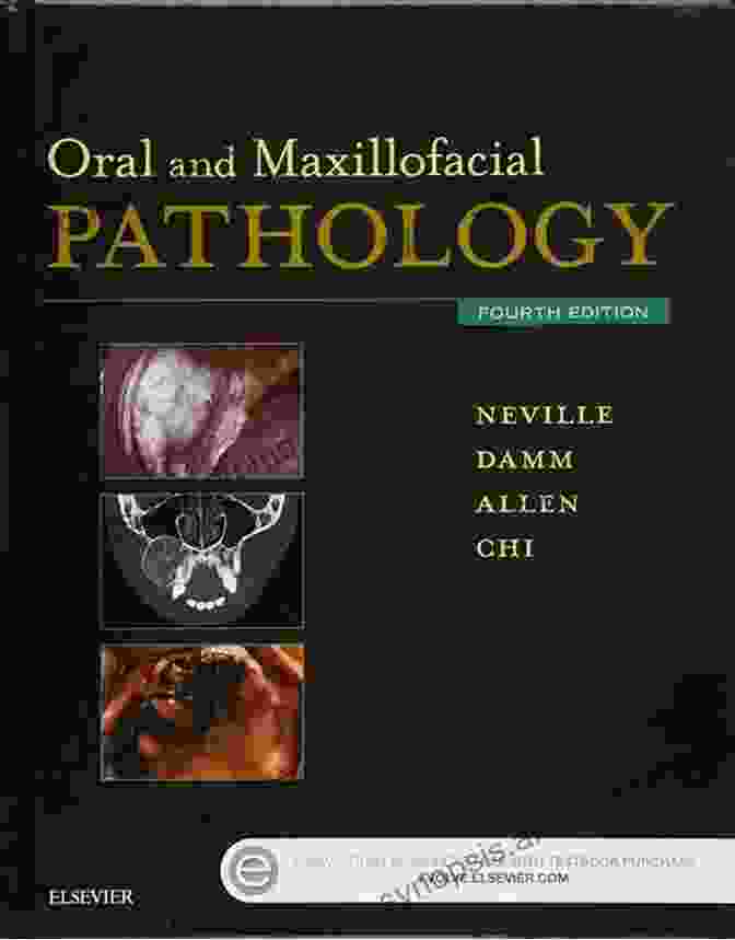 Oral Manifestations Of Systemic Diseases: An Issue Of Atlas Of The Oral And Maxillofacial Pathology Oral Manifestations Of Systemic Diseases An Issue Of Atlas Of The Oral Maxillofacial Surgery Clinics (The Clinics: Dentistry 25)